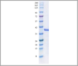 Amyloid Precursor Protein α (304-612), Secreted human (sAPPα 304-612)